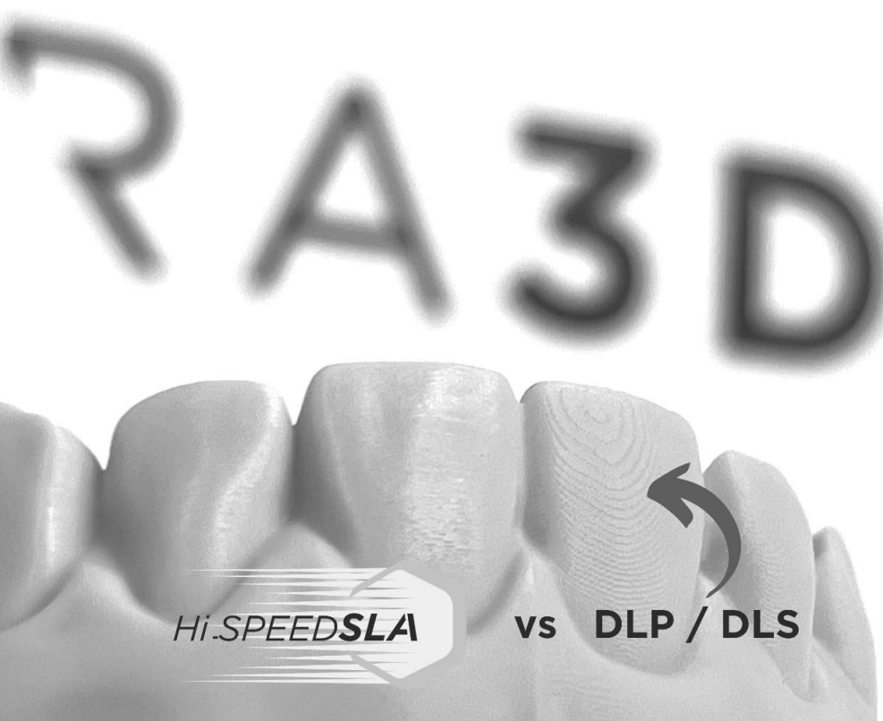 Side-by-side comparison of a dental arch printed with DLP-only technology versus Axtra3D Hybrid PhotoSynthesis